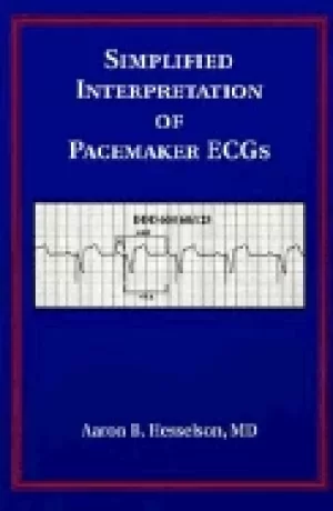 Image of simplified interpretation of pacemaker ecgs
