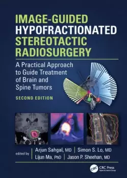 Image of Image-Guided Hypofractionated Stereotactic RadiosurgeryA Practical Approach to Guide Treatment of Brain and Spine Tumors