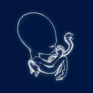 Image of Sigur R&oacute;s &lrm;- &Aacute;gaetis Byrjun Vinyl