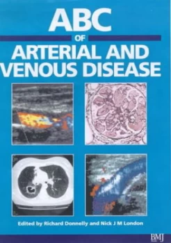 Image of Abc of Arterial and Venous Disease by Richard Donnelly Paperback