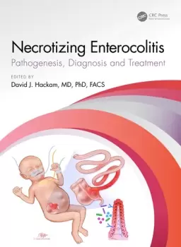 Image of Necrotizing Enterocolitispathogenesis diagnosis and treatment