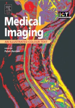 Image of Medical Imaging by Peter Renton Paperback