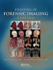 Image of Essentials of Forensic Imaging A Text-Atlas