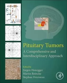 Image of Pituitary Tumors by Jurgen Honegger
