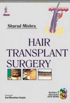Image of Hair transplant surgery by Sharad Mishra
