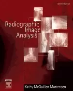 Image of radiographic image analysis