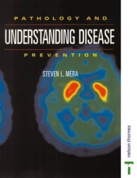 Image of Understanding Disease Prevention by Steven L Mera Paperback