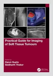 Image of Practical Guide for Imaging of Soft Tissue Tumours
