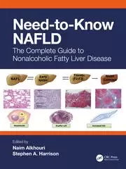 Image of Need-to-Know NAFLD The Complete Guide to Nonalcoholic Fatty Liver Disease