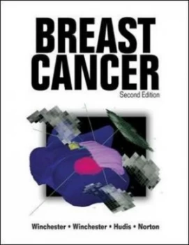 Image of Breast Cancer by David J. Winchester Hardback