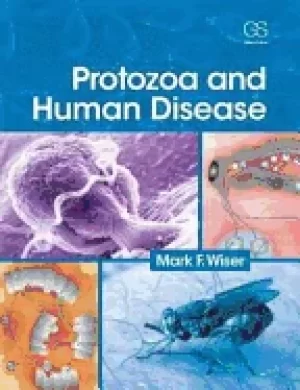 Image of protozoa and human disease