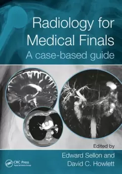 Image of Radiology for Medical FinalsA case-based guide