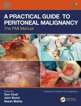 Image of A Practical Guide to Peritoneal MalignancyThe PMI Manual