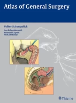 Image of Atlas of General Surgery by Volker Schumpelick