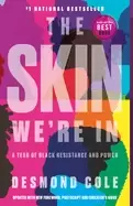 Image of skin were in a year of black