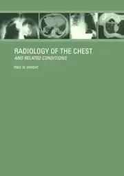 Image of Radiology of the Chest and Related Conditions