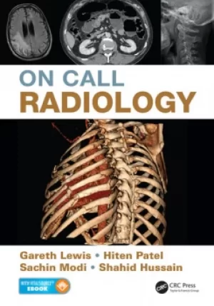 Image of On Call Radiology