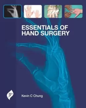 Image of Essentials of Hand Surgery