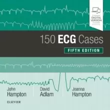Image of 150 ECG Cases