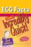 Image of ecg facts made incredibly quick