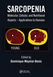Image of Sarcopenia Molecular Cellular and Nutritional Aspects - Applications to Humans