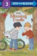 Image of missing tooth