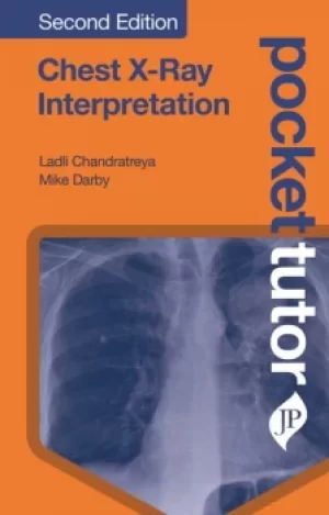 Image of Pocket Tutor Chest X-Ray Interpretation