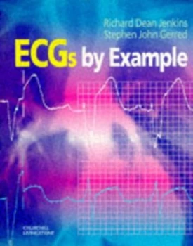 Image of Ecgs by Example by Dean Jenkins Paperback