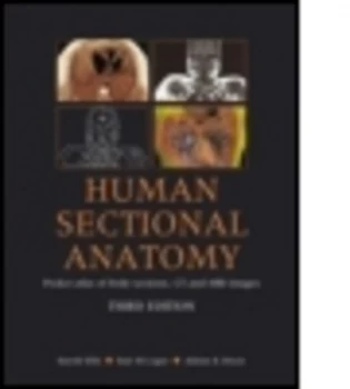 Image of Human Sectional Anatomy by Harold Ellis Paperback