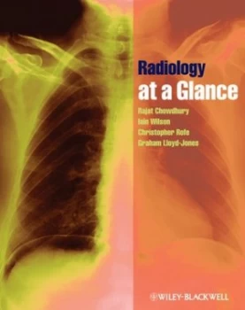 Image of Radiology at a Glance by Rajat Chowdhury Paperback