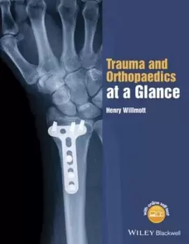 Image of Trauma and orthopaedics at a glance by Henry Willmott