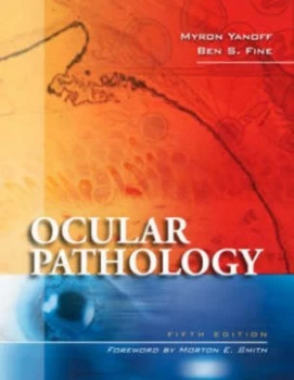 Image of Ocular Pathology by Myron Yanoff Hardback