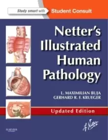 Image of Netter's Illustrated Human Pathology Updated Edition : with Student Consult Access
