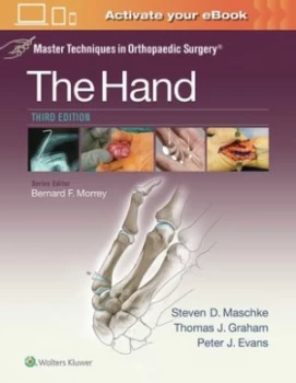 Image of The hand by Thomas J Graham