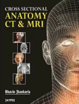 Image of cross sectional anatomy ct and mri