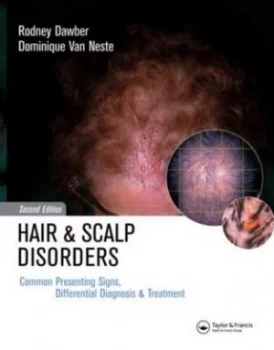 Image of Hair and Scalp Disorders Hardback