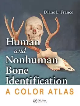 Image of Human and Nonhuman Bone IdentificationA Color Atlas