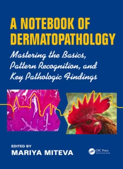 image of A Notebook of DermatopathologyMastering the Basics Pattern Recognition and Key Pathologic Findings