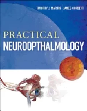 Image of practical neuroophthalmology