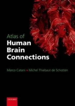 Image of Atlas of Human Brain Connections by Marco Catani Book