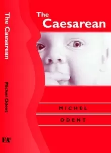 Image of The Caesarean