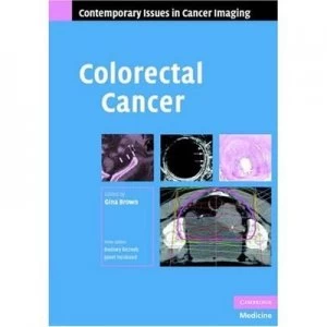 Image of Colorectal Cancer by Gina Brown Hardback