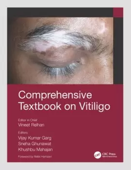 Image of Comprehensive Textbook on Vitiligo