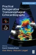 Image of practical perioperative transoesophageal echocardiography text with cd rom