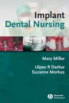 Image of Implant dental nursing by Ulpee R Darbar
