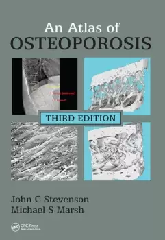 Image of An Atlas of Osteoporosis