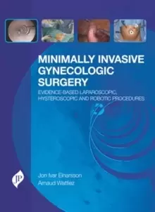 Image of Minimally Invasive Gynecologic Surgery : Evidence-Based Laparoscopic, Hysteroscopic & Robotic Surgeries