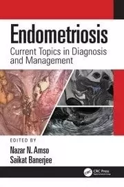 Image of Endometriosis Current Topics in Diagnosis and Management
