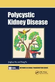 Image of Polycystic Kidney Disease