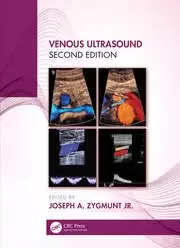 Image of Venous Ultrasound